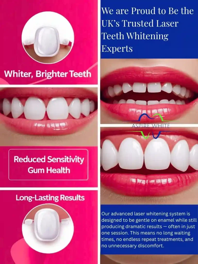 We are Proud to Be the UK’s Trusted Laser Teeth Whitening Experts Nottingham